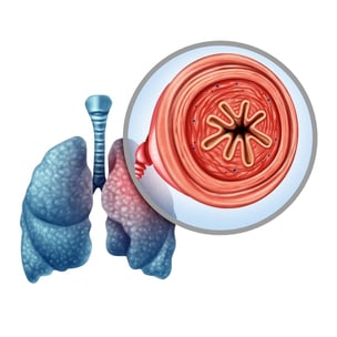 COPD symptoms