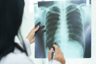 Doctor holding up an X-ray.