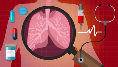 Assorted medical supplies and human lungs (illustration).