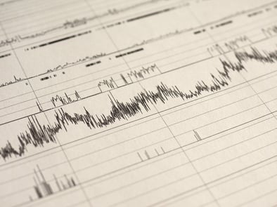 Polysomnograph results.