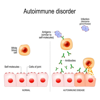 autoimmune disease