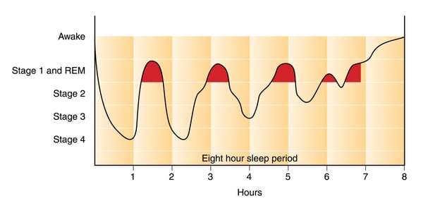 Stages of sleep