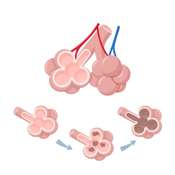 Alveoli