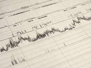 Polysomnography